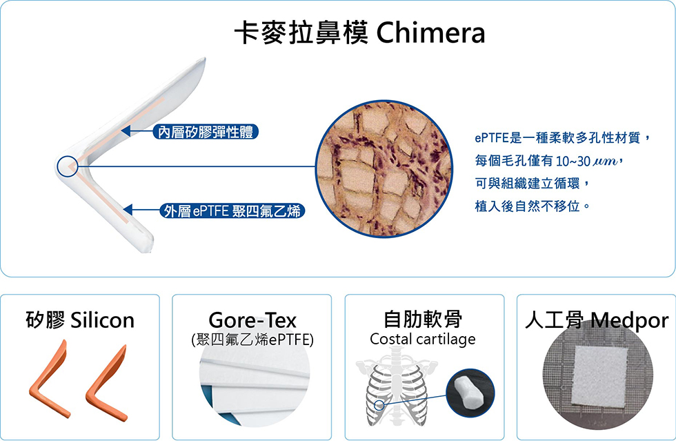 鼻整型 結構式隆鼻 韓式隆鼻 視個人五官塑造出最適合鼻形 Iskin尚行美健康聯合診所