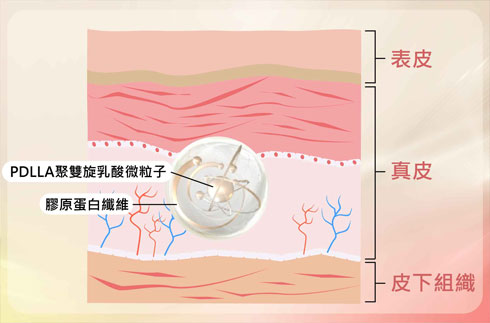 人體吸收後，PDLLA發揮作用，修復肌膚保持彈性。